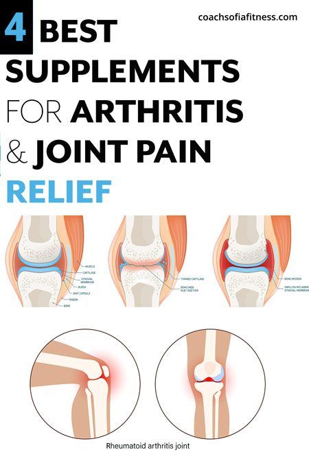 4 Important Arthritis & Joint pain Supplements For Relief Thumb Pain Relief, Joints Pain Remedy, Pain Relief Remedies, Knee Pain Relief, Joints Pain Relief, Healthy Joints, Natural Pain Relief, Best Supplements, Back Pain Relief