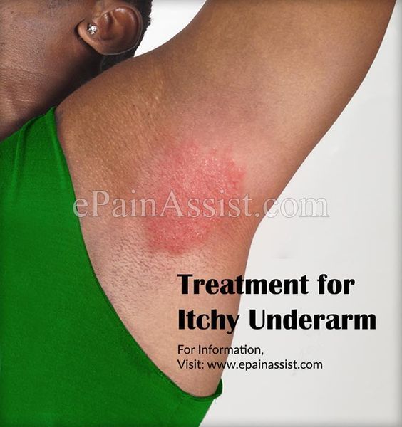 How to Heal Armpit Rashes? Itchy Underarms, Armpit Lump, Armpit Rash, Armpits Smell, Dark Armpits, Beauty Self Care, Taste And See, Alternative Healing, Body Hacks