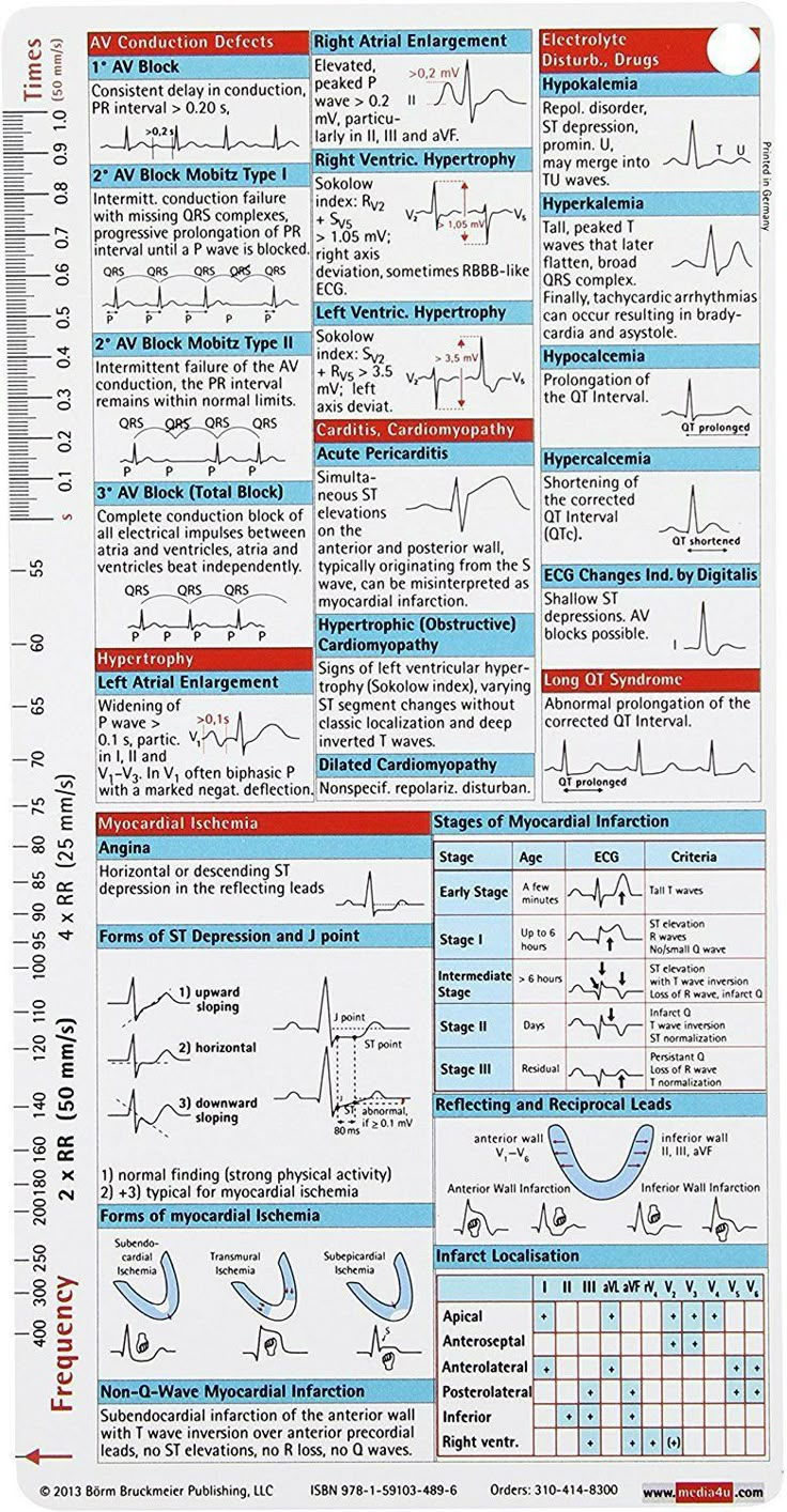 a poster with instructions on how to use an electrocard for the patient's heart rate