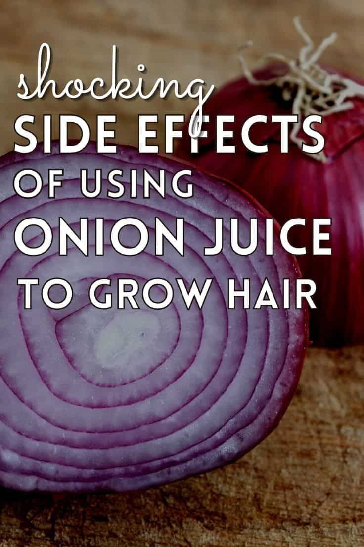 Hair Growth Onion Juice, Onion Remedy For Hair Growth, Onion Oil Benefits, Natural Remedy Hair Growth, Rosemary Onion Hair, Drinking Onion Water Benefits, How To Make Onion Water For Hair Growth, Onion Oil For Hair Growth Diy, Benefits Of Onion Water