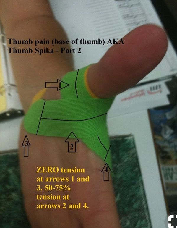 Thumb Taping, Thumb Pain Relief, Physio Tape, K Tape, Kt Tape, Kinesio Taping, Nurse Study Notes, Wrist Pain, Kinesiology Taping