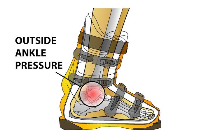 an ankle is shown with the words outside ankle pressure on it and in front of it,