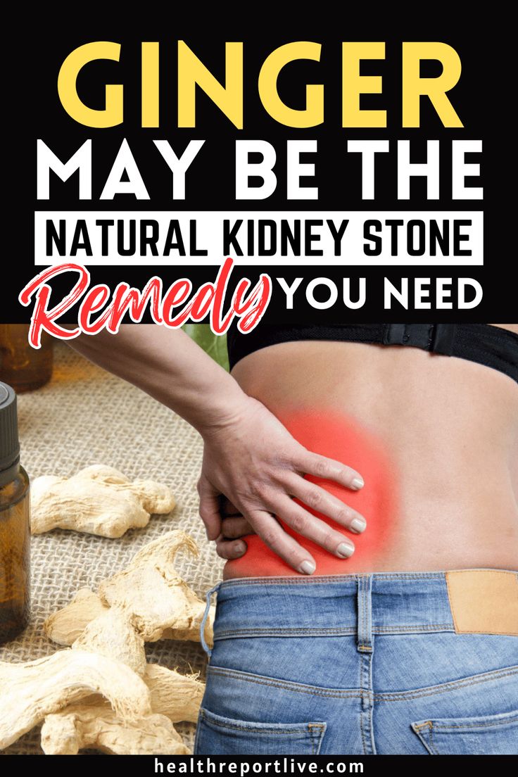 Ginger may be the Natural Kidney Stone Remedy You Need Kidney Stone Prevention Diet, Kidney Stone Foods To Eat, Essential Oils For Kidney Stone Pain, Dissolve Kidney Stone Naturally, Natural Kidney Stone Remedies, Kidney Inflammation Remedies, Diy Kidney Stone Remedy, Kidney Stone Symptoms In Women, How To Pass A Kidney Stone Fast