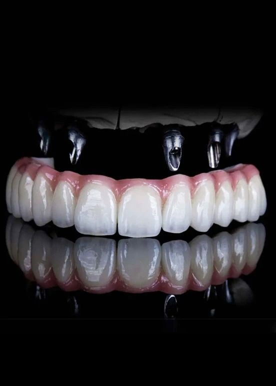 Best Dental Implants | All On 4 Dental Implants All On 4 Dental Implants, Dental Implant Procedure, Denture Implants, Best Dental Implants, Dental Implants Cost, Tooth Replacement, Social Media Branding Design, Texture Material, Missing Teeth