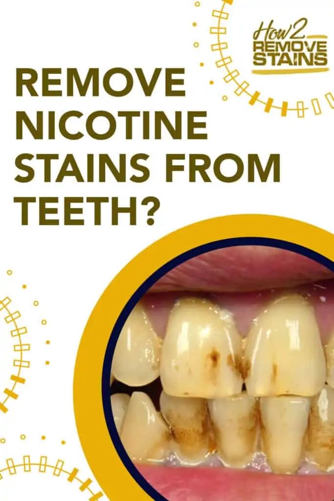 How to remove nicotine stains from teeth [ Detailed Answer ] Teeth Stain Remover, Teeth Whitening Diy, Nice Teeth, Teeth Health, Oral Care Routine, Gum Care, Stained Teeth, Natural Teeth Whitening, Oral Health Care