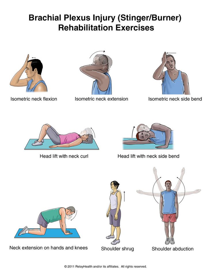 an exercise poster showing how to use the brachia plexus injury / stingburn