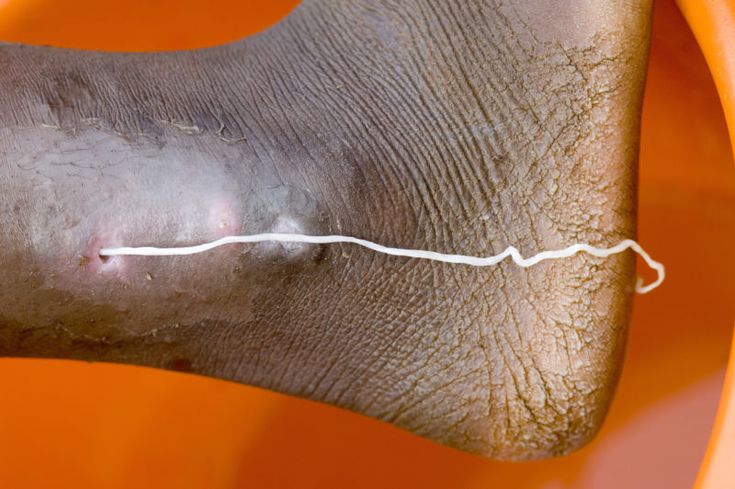 an elephant's foot is shown with white thread on the tip of its trunk