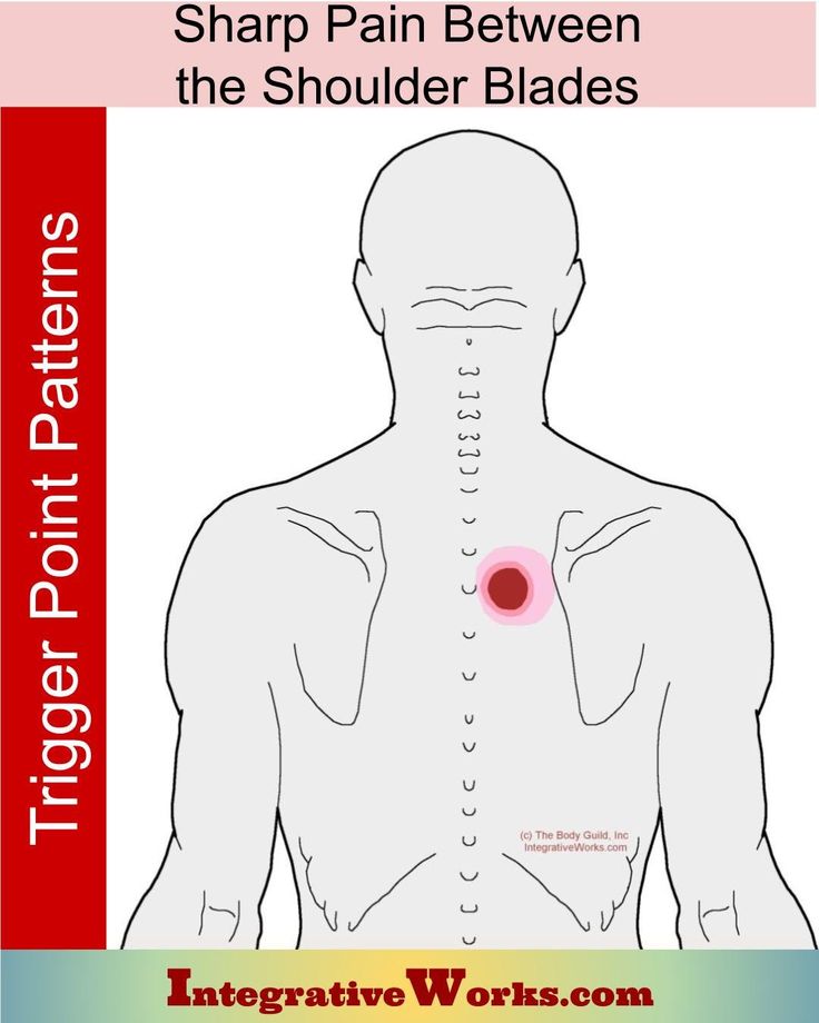 Sharp Pain Between the Shoulder Blades - Integrative Works Tattoo Between Shoulder Blades, Back Spasm Relief, Muscle Spasms Relief, Shoulder Blade Stretch, Therapist Notes, Back Pain Massage, Neck And Shoulder Stretches, Forward Head Posture Exercises, Back Spasm