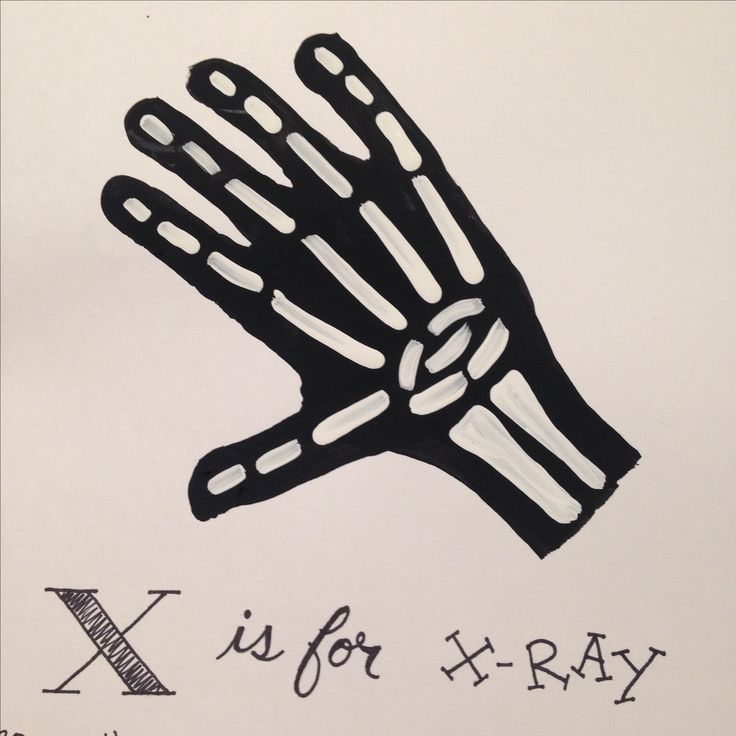 a black and white drawing of a hand with the words x is for h - ray