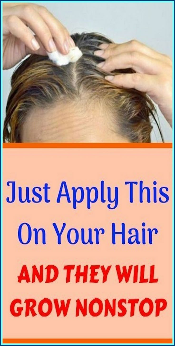 Just Apply This on Your Hair and They Will Grow Nonstop Healthy Natural Hair Growth, Help Hair Grow, Make Hair Grow, Hair Growing Tips, Hair Remedies For Growth, Grow Long Hair, Healthy Natural Hair, Hair Remedies, Hair Food