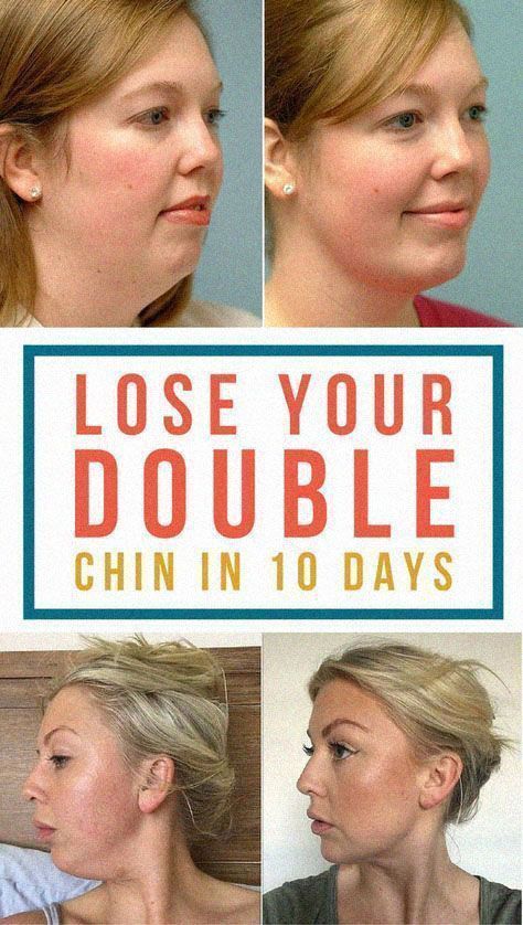 How to Lose Chubby Cheeks in 10 days Turkey Neck Exercises, Rid Of Double Chin, Facial Exercise, Double Chin Exercises, Chin Exercises, Double Menton, Turkey Neck, Neck Exercises, Face Exercises