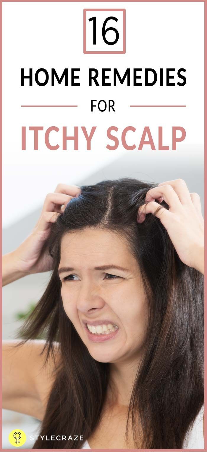 An itchy scalp may be irritating for anyone, especially during the hot summers. Instead of trying a host of market products and professional treatments, use these regular and popular home remedies to eliminate the itchiness from your scalp. Remedies For Itchy Scalp, Itchy Scalp Remedy, Thick Hair Remedies, Dry Itchy Scalp, Flaky Scalp, Hair Roots, Hair Remedies For Growth, Excess Hair, Grow Hair Faster