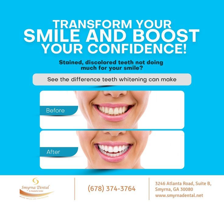 If you are not happy with your smile and believe that teeth whitening can improve your smile and give you that edge, talk to us at (678) 374-3764. We will help you achieve your dental goals 😁✨ #TeethWhitening #smyrna #GA #smyrnadental Teeth Whitening Procedure, Dental Posts, Discolored Teeth, Sedation Dentistry, Family Dentist, Dental Art, General Dentistry, Family Dentistry, Oral Health Care