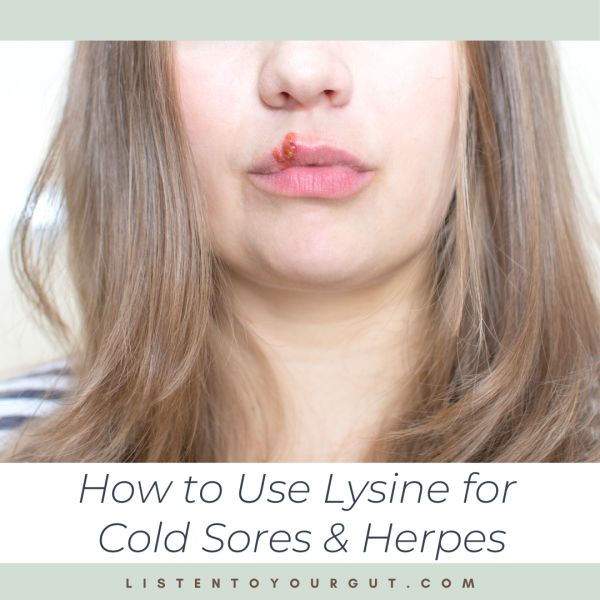 L Lysine Benefits Cold Sore, Lysine For Cold Sores, Benefits Of Lysine, Cold Sore Remedy Fast, L Lysine Benefits, Blister On Lip, Remedies For Dry Mouth, Vertigo Remedies, Home Remedies For Warts