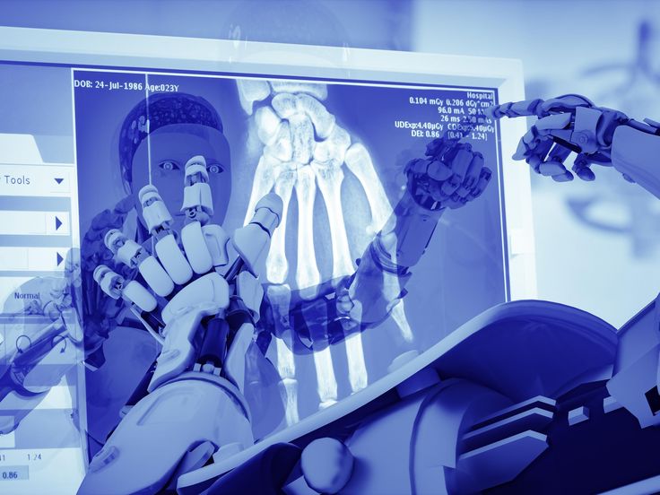 a computer screen with an image of a robotic hand on it