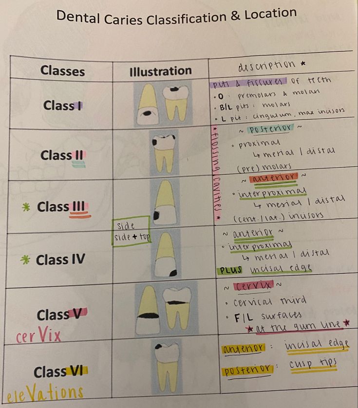 Dental Hygiene Study, Dental Assisting Study, Dental Assistant Organization, Dental Hygienist Lifestyle, Gv Black Caries Classification, Dental Assistant Cheat Sheet, Dental Terminology Cheat Sheet, Dental Hygiene School Notes, Dental Assisting Study Notes