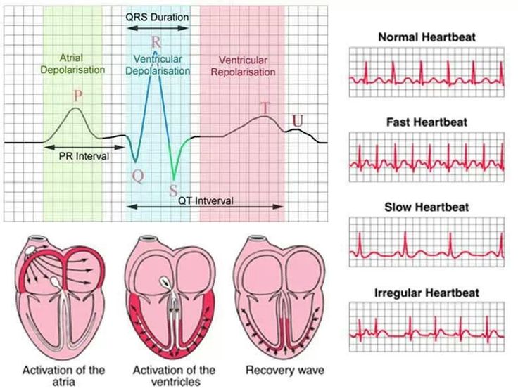 Cardiology Cardiovascular Technologist, Ekg Interpretation, Ecg Interpretation, Nursing 101, Vet Nurse, Study Stuff, Heart Anatomy, Cardiac Nursing, Nursing School Survival