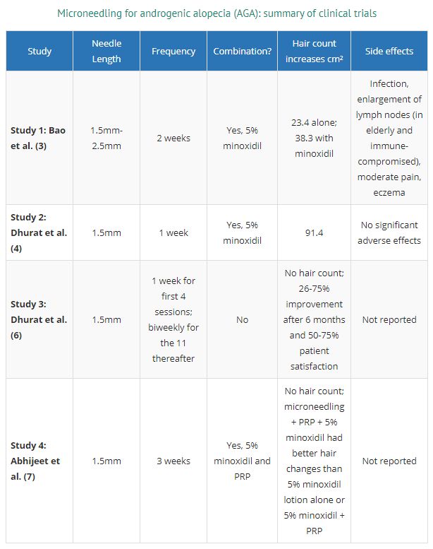 How Often Microneedling for Hair Loss? Microneedling Hair Growth, Microneedling For Hair Growth, Alopecia Hair Growth, Signs Of Inflammation, Androgenic Alopecia, Thicker Healthier Hair, Low Level Laser Therapy, Micro Needling, Androgenetic Alopecia