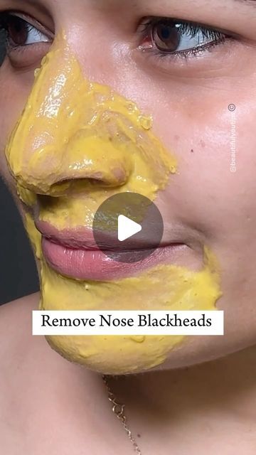 𝑩𝒆𝒂𝒖𝒕𝒊𝒇𝒖𝒍 𝒀𝒐𝒖 𝑻𝒊𝒑𝒔 on Instagram: "Nose & Chin blackhead, Whitehead removal, easy home-made remedy. Try this weekly, two time and you get best result get rid of blackhead Whitehead dead skin and get glass like shiny, healthy skin from your nose and chin areas, especially also you can ask me if you have any query or any doubt in the comment section Love to answer.❤️. . . . . . Follow for more. #skincare #beauty #beautytips #reels #blackheads" Home Remedy For Blackheads On Nose, Home Remedies For Blackheads, Nose Blackheads Removal At Home, How To Remove Blackheads At Home, How To Remove Blackheads From Nose, Blackheads Remedy, Remove Blackheads From Nose Homemade, Home Remedy For Blackheads, Black Head Remover Diy