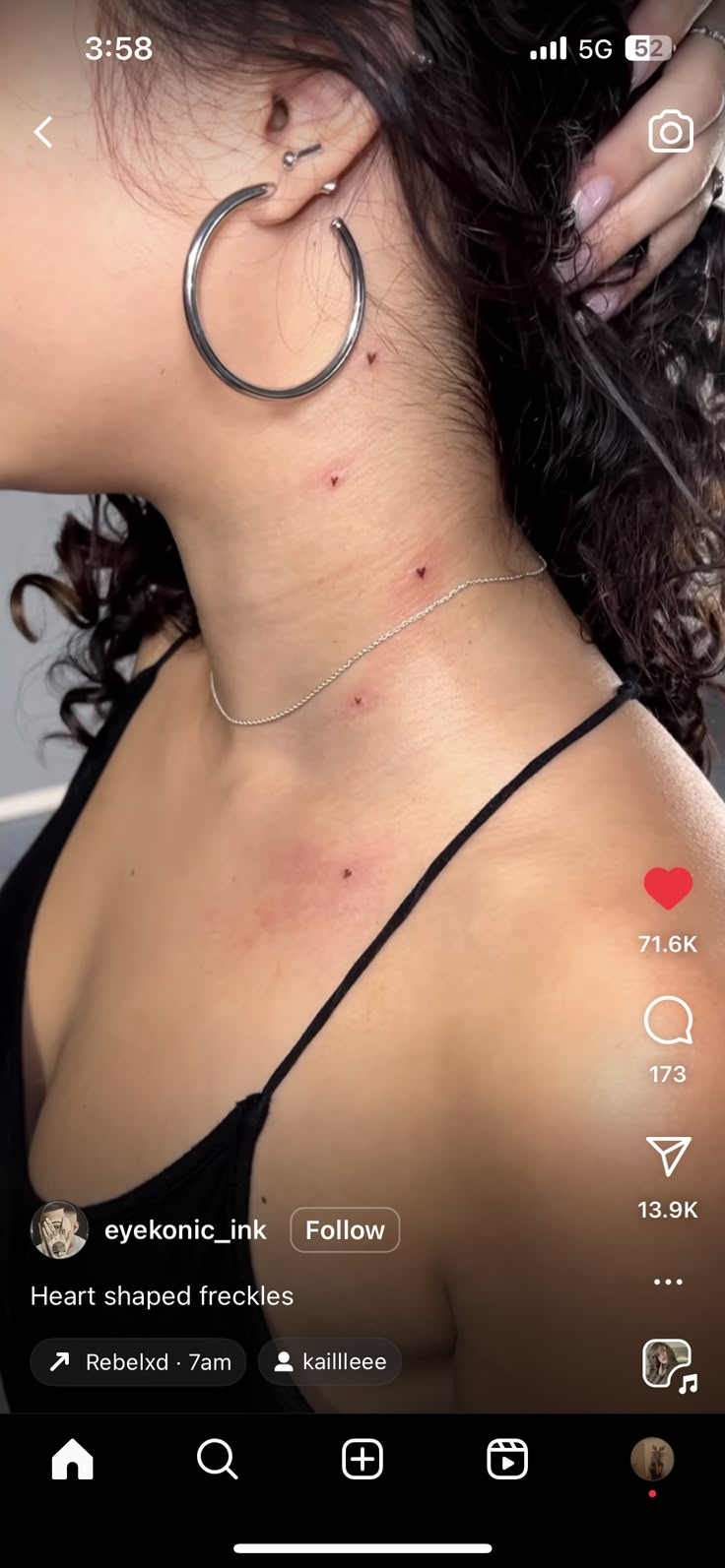 the back of a woman's neck with acne