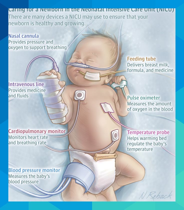 a baby with an inhaler attached to it's back and the words caring for