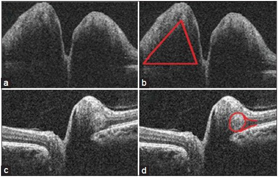 four images show different angles and shapes of the human's shoulder, including an x - ray