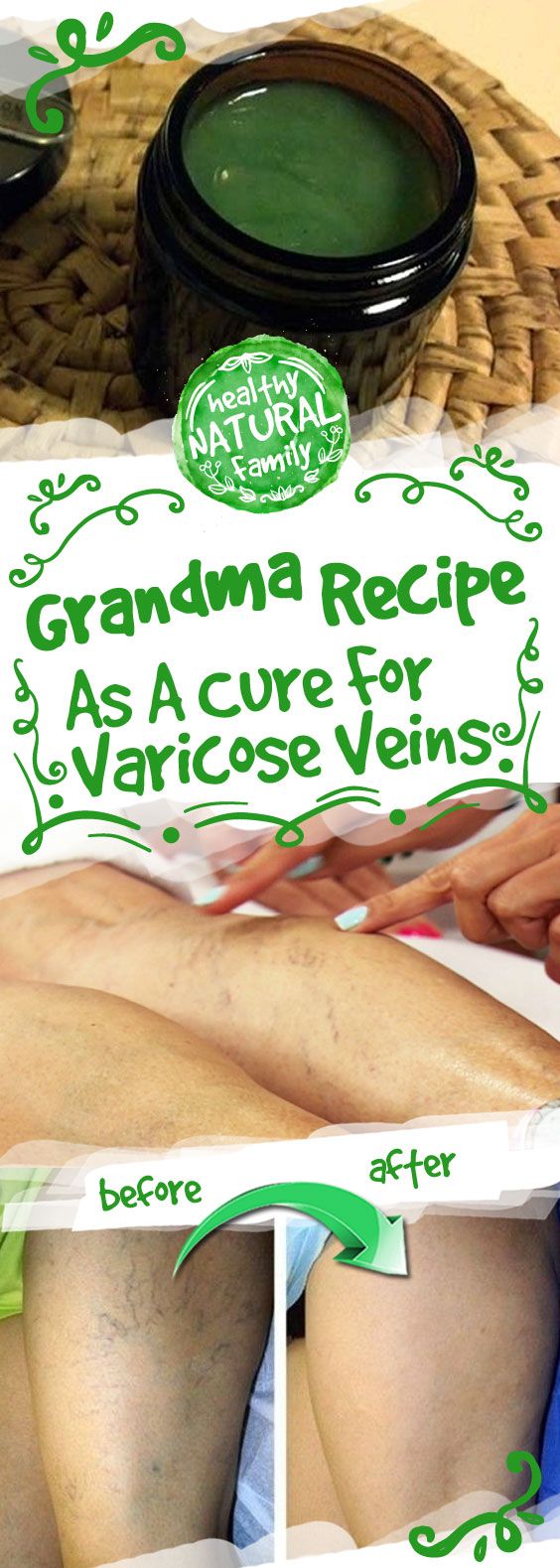 Grandma Recipe As A Cure For Varicose Veins – Toned Cheezburger Funny, Home Remedies For Spiders, Varicose Vein Remedy, Instagram Jokes, Grandmas Recipes, Diy Health, Natural Home Remedies, Natural Medicine, During Pregnancy