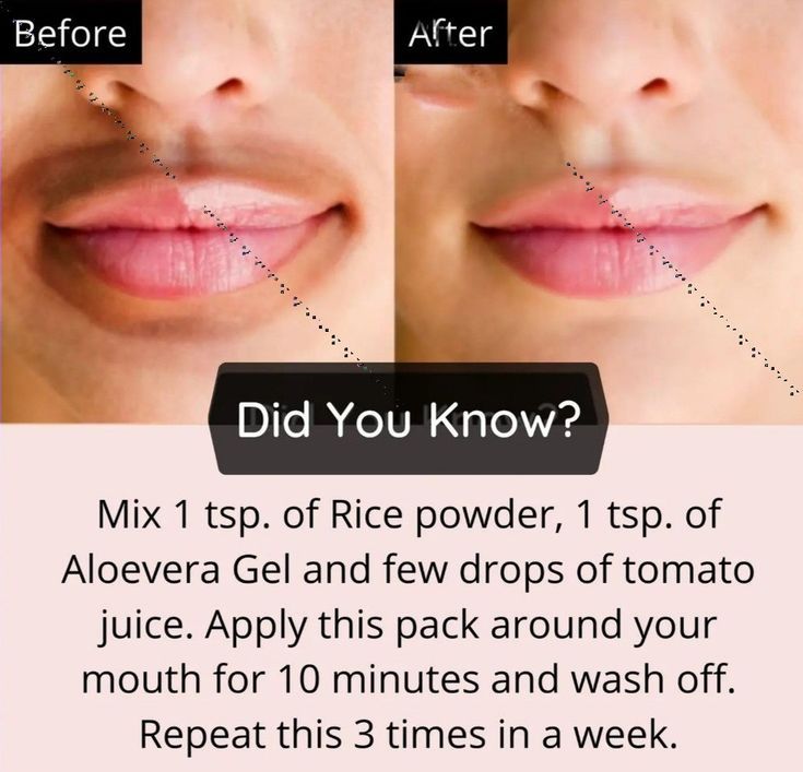 Lips Lightening, Aloe Vera Toner, Natural Aloe Vera Gel, Beginner Skin Care Routine, Skin Care Pictures, Model Skincare, Skin Care Basics, Face Skin Care Routine, Clear Skin Face