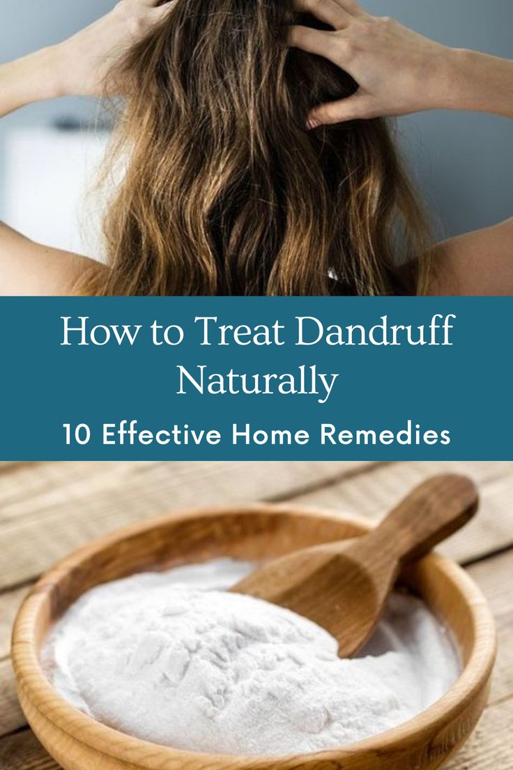 Dandruff is a common scalp problem that can cause itching and flaking. It can also lead to other skin issues like acne and pimples. But you don’t have to use harsh chemicals or spend money on anti-dandruff products or treatments. You can treat dandruff naturally with 10 effective home remedies that use simple and natural ingredients. #dandruff #homeremedies #naturalbeauty #haircare #scalphealth #dandrufftreatment #dandruffremedies #dandruffcure #dandrufffree #dandrufftips Best Natural Dandruff Remedy, Natural Way To Get Rid Of Dandruff, Diy For Dandruff Dry Scalp, Best Hair Oil For Dandruff, Remedy For Dandruff Dry Scalp, How Remove Dandruff Hair, Best Remedy For Dandruff, Scalp Scrub Diy Dandruff Remedy, How To Treat Dandruff Naturally