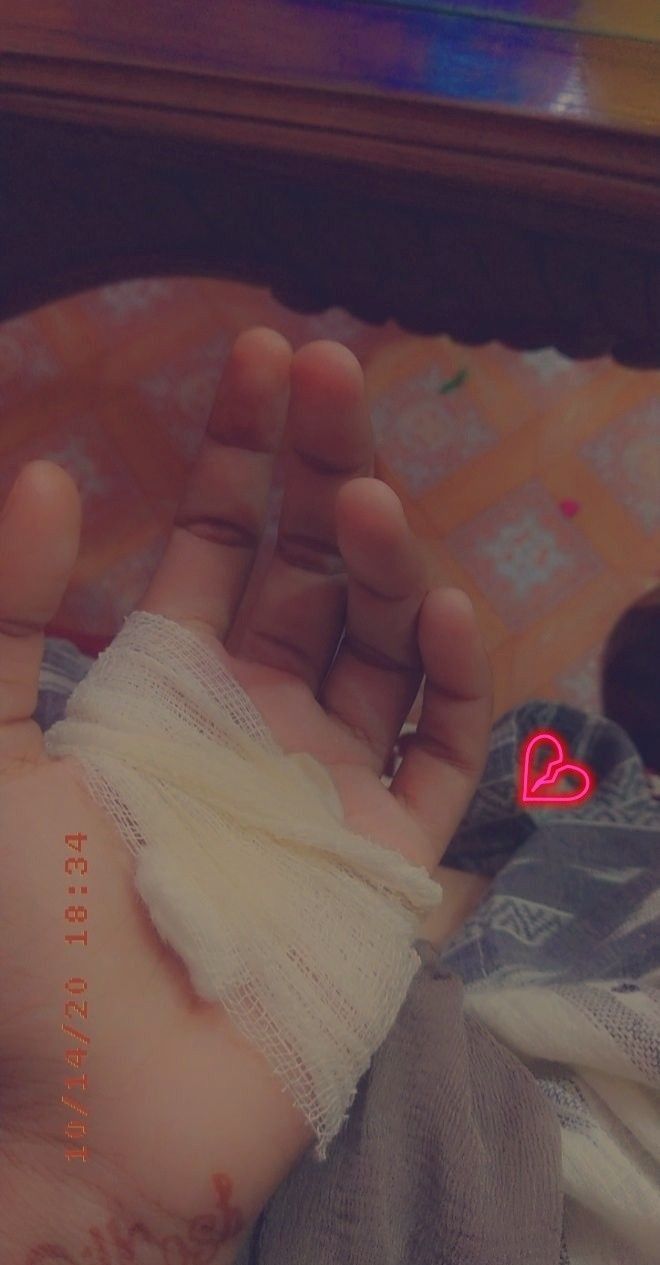 a hand with a bandage on it and a red light in the background that says, i love you