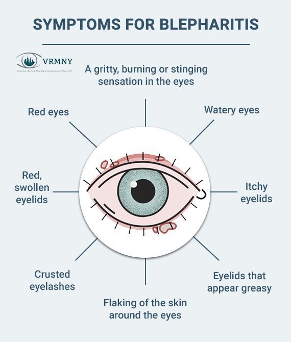 Eye Health Facts, Optometry Education, Eye Disorders, How To Help Nausea, Eye Facts, Irritated Eye, Biology Facts, Eye Infections, Digital Marketing Design