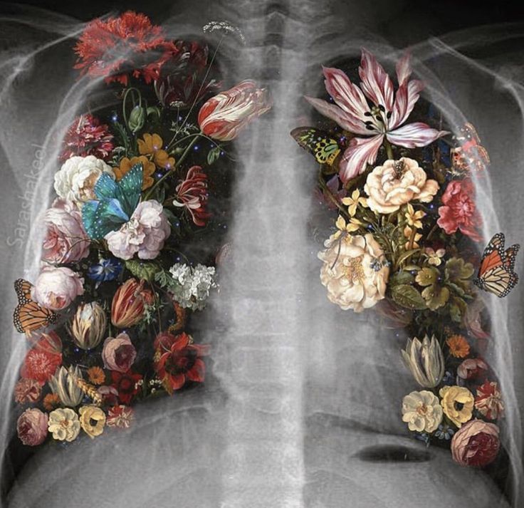 an x - ray shows the lungs with flowers and butterflies on it's chest