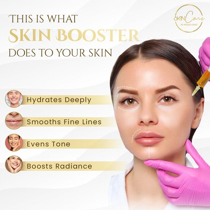 Know more about the benefits of Skin boosters and dive deep into your skincare routine 🥽🧏. 🌸 Hydrates Deeply: Fulfil your skin's thirst with deep hydration, smoothing away fine lines for a youthful glow that shines from within ✨. 🌸Smooths Fine Lines: Our formula works as magic, making your skin smoother and more supple than ever before 💆. 🌸Even Tones: Achieve complexion perfection with even-toned skin that radiates confidence and beauty 🥰. 🌸 Boosts Radiance: Shine bright like a star when ... Skin Booster, Instagram Branding Design, Social Media Branding Design, Skin Care Benefits, Botox Fillers, Perfect Complexion, Clear Skin Tips, Aesthetic Clinic, Skin Care Clinic