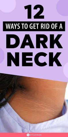 How To Get Rid Of Dark Neck: 13 Effective Home Remedies To Try How To Get Rid Of Dark Neck At Home, Dark Skin Around Neck, Dark Neck Remedies, Get Rid Of Dark Neck, Dark Neck, Detox Body, Wrinkle Remedies, Skin Advice, Dark Spots On Face