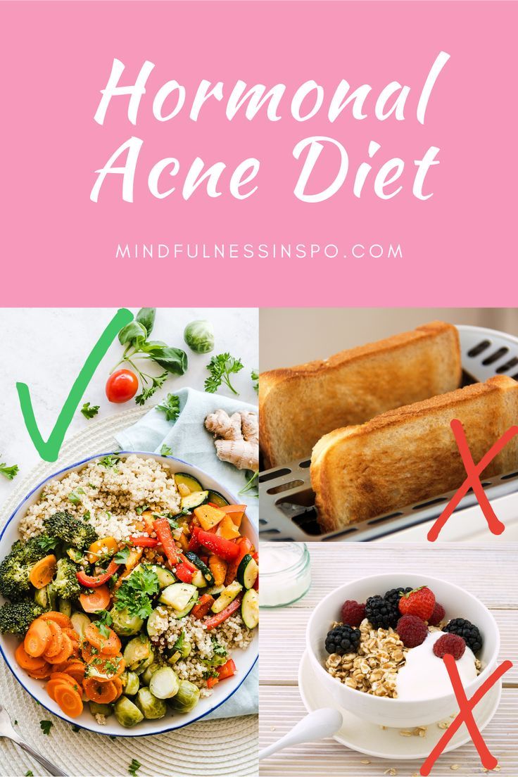 Clean Skin Diet, Foods To Clear Acne, Healthy Adult Lunches, Skin Diet Plan, Skin Treatments For Acne, Skin Care Routine Acne, Anti Acne Diet, Food For Dry Skin, Food For Acne