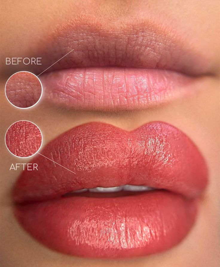 Cosmetic Lip Tattoo, Lip Permanent Makeup, Lip Blushing, Permanent Lipstick, Coral Lips, Lip Blush, Semi Permanent Makeup, Ingrown Hairs, Ombre Lips