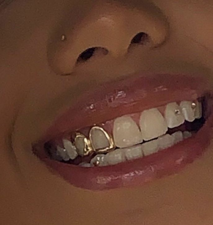 Grillz Aesthetic, Gold Teeth Grills, Tooth Gems Ideas, Smile Tips, Girl Grillz, Teeth Aesthetic, Pretty Teeth, Dental Jewelry, Grillz Teeth