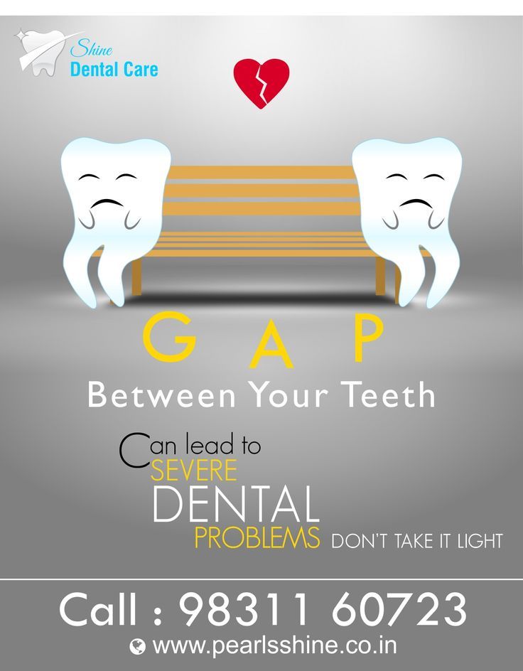 Dental Clinic Promotion Ideas, Dental Care Creative Ads, Dental Promotion Ideas, Dentist Advertising, Dental Ads, Dentist Marketing, Dental Wallpaper, Dental Quotes, Dental Advertising