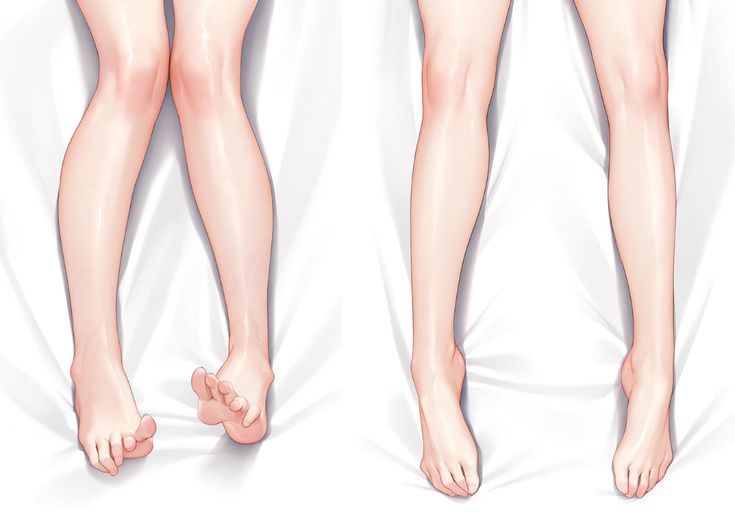 the legs and ankles of a woman with varicons on her feet, from top to bottom