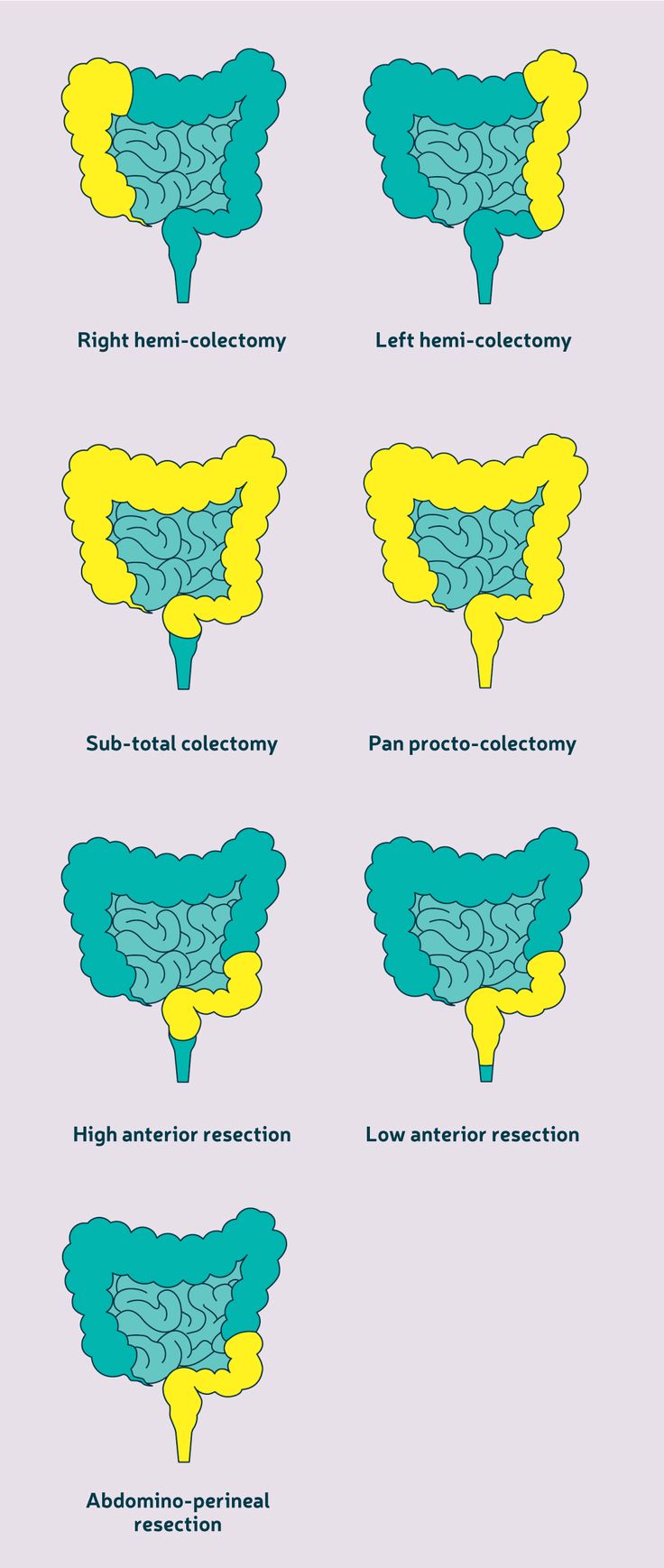 an image of different types of clouds in the shape of people's stomachs