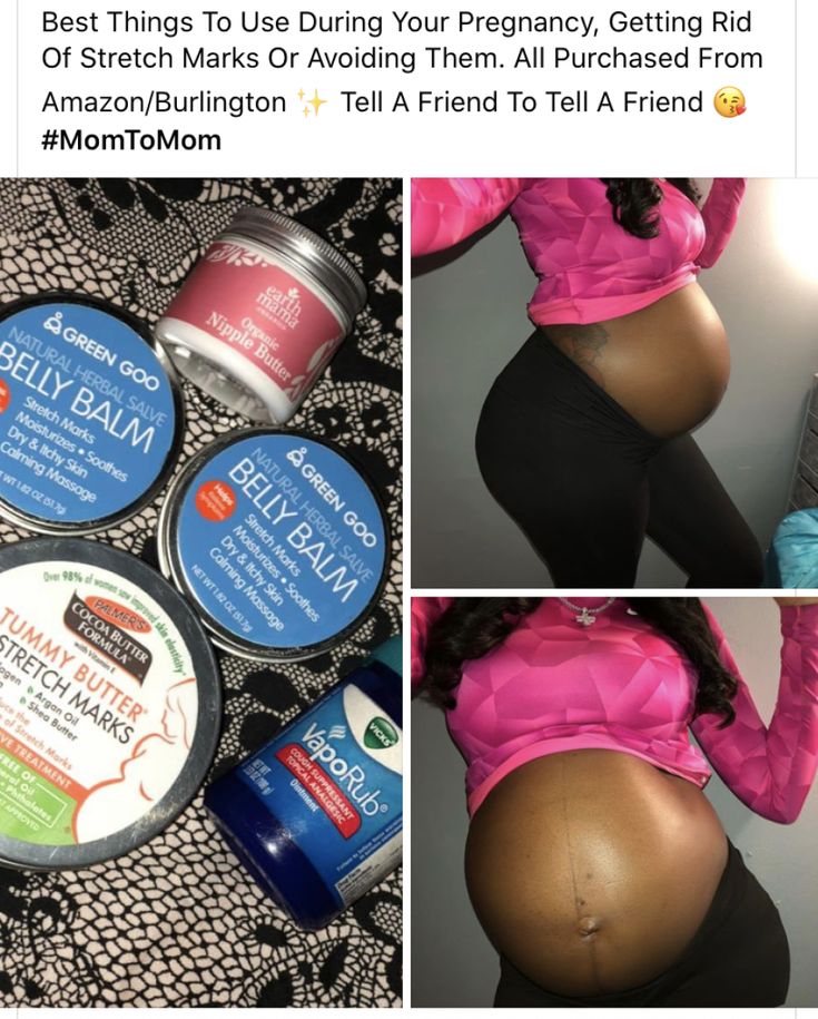 the pregnant belly is surrounded by products for her baby bump, and it's been taken