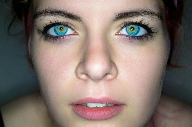 20 people with the most strikingly beautiful eyes. – Page 13 of 20 Heterochromia Eyes, Rare Eye Colors, Multi Colored Eyes, Rare Eyes, Birth Colors, Beautiful Eyes Color, Different Colored Eyes, Color Eyes, Most Beautiful Eyes