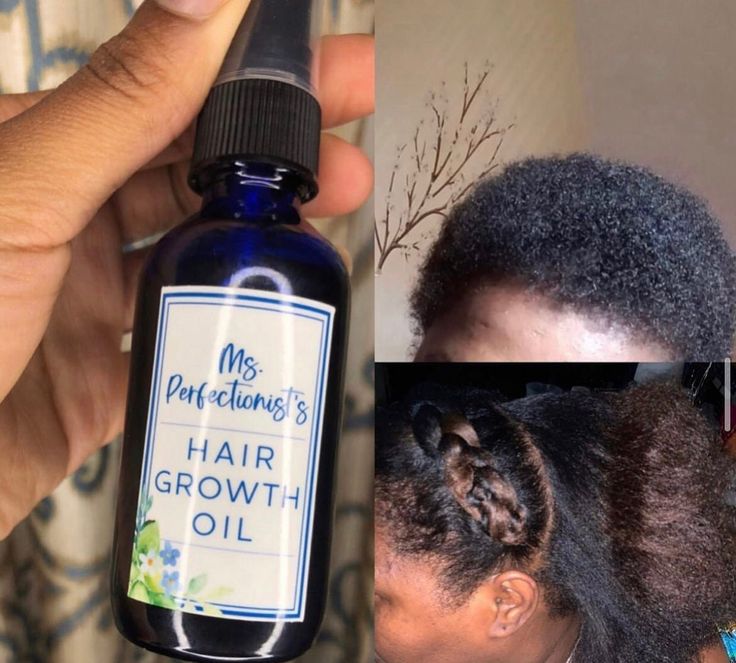 If you're looking for something to help you with dry scalp, if you want you hair to grow and get thicker. You should try using my hair growth oil  Ingredients: Rosemary oil, Lavender Oil, Hair Fertilizer, Castor Oil, Rice Water, Pepperment Oil & Argan Oil. Black Women Hair Growth, Hair Fertilizer, Black Women Hair, Rice Water, How To Get Thick, Oil Hair, Rosemary Oil, Dry Scalp, Growth Oil