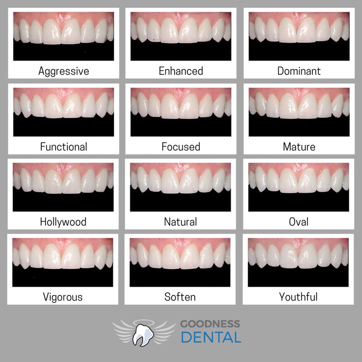 Round Teeth Shape, Fang Teeth Natural, Types Of Teeth Shapes, Teeth Bonding Before And After, Natural Fangs Teeth, Teeth Fangs Natural, Fangs Smile, Perfect Teeth Aesthetic, Natural Fangs