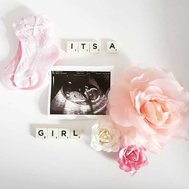 baby announcement cards with pink flowers, socks and an x - ray image on them