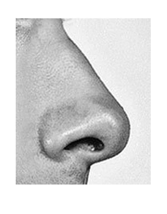 a black and white photo of a man's nose with an oval shaped nose