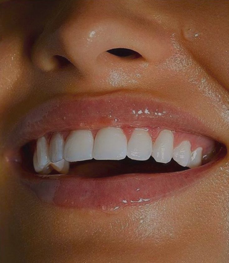 Manifestation Results, Whiten Teeth Fast, Peroxide Teeth Whitening, Teeth Aesthetic, Pretty Teeth, Beautiful Teeth, Teeth Whitening Gel, Straight Teeth, Perfect Teeth