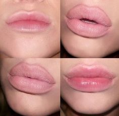 Before & After fullips lip enhancer Juvederm Lips, Cosmetic Injectables, Lip Augmentation, Lip Enhancement, Lip Filler, Botox Fillers, Lipstick Art, Lip Tattoos, Lip Injections