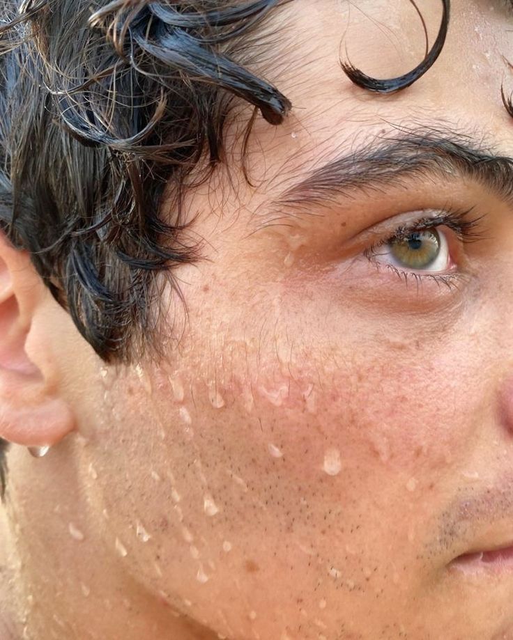 a man with wet hair and freckles on his head looking at the camera