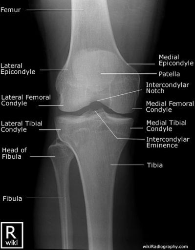 an x - ray view of the knee showing different types of bones